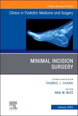 Abbildung von Blitz | Minimal Incision Surgery, An issue of Clinics in Podiatric Medicine and Surgery | 1. Auflage | 2024 | beck-shop.de