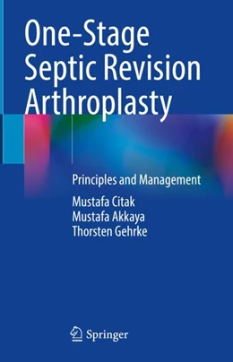 Abbildung von Citak / Akkaya | One-Stage Septic Revision Arthroplasty | 1. Auflage | 2024 | beck-shop.de