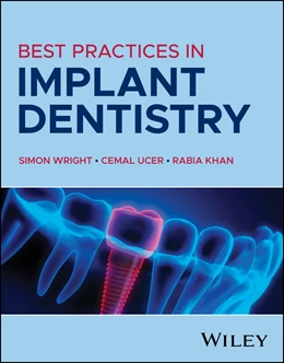 Abbildung von Ucer / Khan | Best Practices in Implant Dentistry | 1. Auflage | 2025 | beck-shop.de