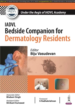 Abbildung von Vasudevan / Singh | IADVL Bedside Companion for Dermatology Residents | 1. Auflage | 2024 | beck-shop.de