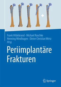 Abbildung von Hildebrand / Raschke | Periimplantäre Frakturen | 1. Auflage | 2025 | beck-shop.de