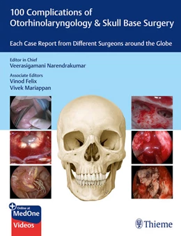 Abbildung von Narendrakumar | 100 Complications of Otorhinolaryngology & Skull Base Surgery | 1. Auflage | 2024 | beck-shop.de