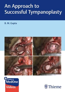 Abbildung von Gupta | An Approach to Successful Tympanoplasty | 1. Auflage | 2024 | beck-shop.de