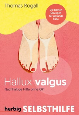 Abbildung von Rogall | Hallux Valgus | 1. Auflage | 2024 | beck-shop.de