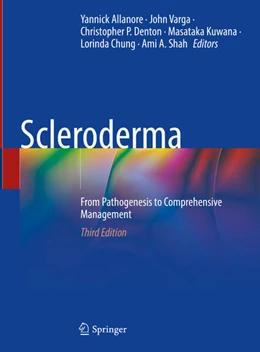 Abbildung von Allanore / Varga | Scleroderma | 3. Auflage | 2024 | beck-shop.de