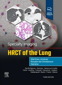 Abbildung von Martínez-Jiménez / Rosado-De-Christenson | Specialty Imaging: HRCT of the Lung | 3. Auflage | 2025 | beck-shop.de