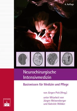 Abbildung von Piek / Meixensberger | Neurochirurgische ¿Intensivmedizin | 4. Auflage | 2017 | beck-shop.de