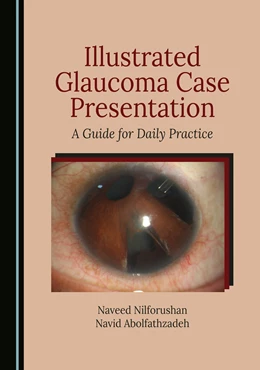 Abbildung von Nilforushan / Abolfathzadeh | Illustrated Glaucoma Case Presentation | 1. Auflage | 2024 | beck-shop.de