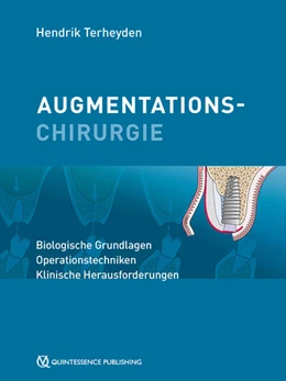 Abbildung von Terheyden | Augmentationschirurgie | 1. Auflage | 2021 | beck-shop.de