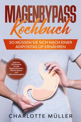 Abbildung von Müller | Magenbypass Kochbuch: So müssen Sie sich nach einer Adipositas OP ernähren | 1. Auflage | 2024 | beck-shop.de