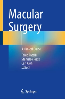 Abbildung von Patelli / Rizzo | Macular Surgery | 1. Auflage | 2024 | beck-shop.de