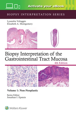 Abbildung von VOLTAGGIO / MONTGOMERY | Biopsy Interpretation of the Gastrointestinal Tract Mucosa Volume 1 | 4. Auflage | 2024 | 1 | beck-shop.de