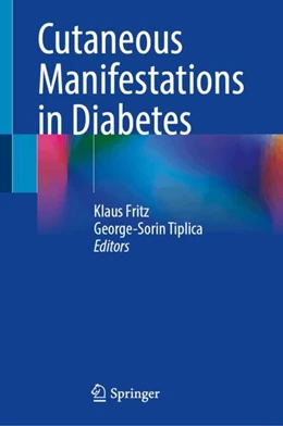 Abbildung von Fritz / Tiplica | Cutaneous Manifestations in Diabetes | 1. Auflage | 2024 | beck-shop.de