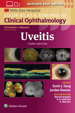 Abbildung von Garg | Uveitis | 3. Auflage | 2024 | beck-shop.de