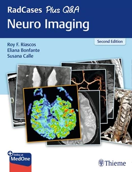 Abbildung von Riascos-Castaneda / Bonfante | RadCases Plus Q&A Neuro Imaging | 2. Auflage | 2019 | beck-shop.de