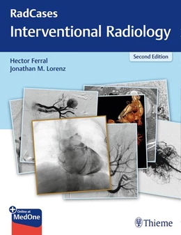Abbildung von Ferral / Lorenz | RadCases Q&A Interventional Radiology | 2. Auflage | 2018 | beck-shop.de