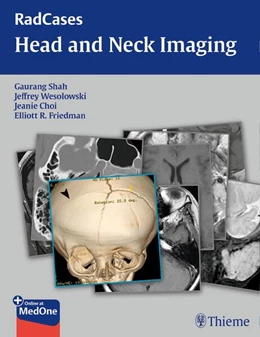 Abbildung von Shah / Wesolowski | RadCases Head and Neck Imaging | 1. Auflage | 2016 | beck-shop.de