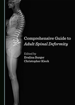 Abbildung von Burger / Kleck | Comprehensive Guide to Adult Spinal Deformity | 1. Auflage | 2024 | beck-shop.de