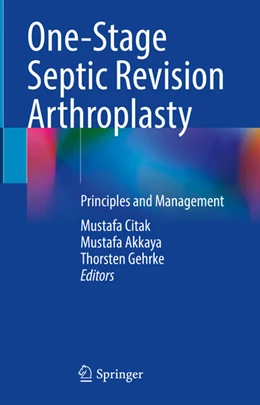 Abbildung von Citak / Akkaya | One-Stage Septic Revision Arthroplasty | 1. Auflage | 2024 | beck-shop.de