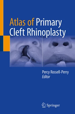 Abbildung von Rossell-Perry | Atlas of Primary Cleft Rhinoplasty | 1. Auflage | 2024 | beck-shop.de