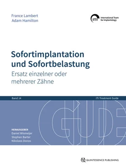 Abbildung von Wismeijer / Barter | Sofortimplantation und Sofortbelastung | 1. Auflage | 2024 | beck-shop.de