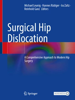 Abbildung von Leunig / Rüdiger | Surgical Hip Dislocation | 1. Auflage | 2025 | beck-shop.de