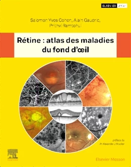 Abbildung von Cohen / RAMTOHUL | Rétine : atlas des maladies du fond d'oeil | 1. Auflage | 2025 | beck-shop.de