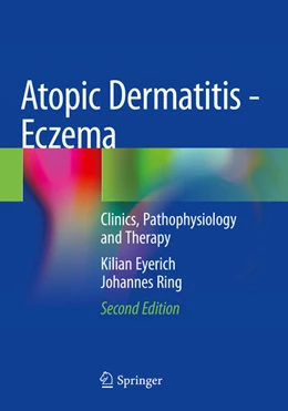 Abbildung von Eyerich / Ring | Atopic Dermatitis - Eczema | 2. Auflage | 2024 | beck-shop.de