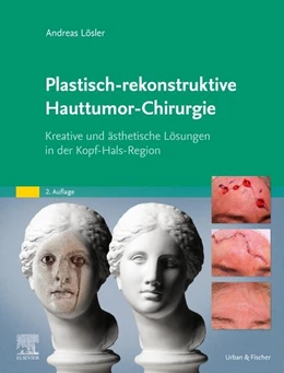 Abbildung von Lösler | Plastisch-rekonstruktive Hauttumor-Chirurgie | 2. Auflage | 2024 | beck-shop.de