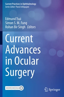 Abbildung von Tsui / Fung | Current Advances in Ocular Surgery | 1. Auflage | 2024 | beck-shop.de