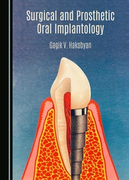 Abbildung von Hakobyan | Surgical and Prosthetic Oral Implantology | 1. Auflage | 2024 | beck-shop.de