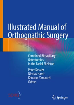 Abbildung von Kessler / Hardt | Illustrated Manual of Orthognathic Surgery | 1. Auflage | 2025 | beck-shop.de