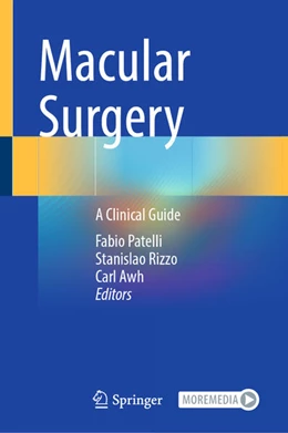 Abbildung von Patelli / Rizzo | Macular Surgery | 1. Auflage | 2024 | beck-shop.de