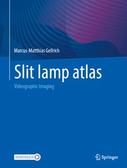 Abbildung von Gellrich | Slit lamp atlas | 1. Auflage | 2025 | beck-shop.de