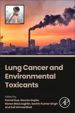 Abbildung von Gupta / MacLoughlin | LUNG CANCER TOXICANTS | 1. Auflage | 2025 | beck-shop.de