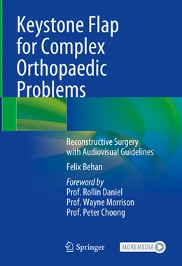 Abbildung von Behan | Keystone Flap for Complex Orthopaedic Problems | 1. Auflage | 2025 | beck-shop.de