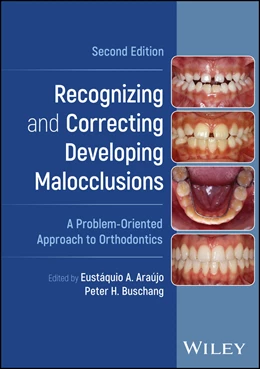 Abbildung von Araujo / Buschang | Recognizing and Correcting Developing Malocclusions | 2. Auflage | 2025 | beck-shop.de