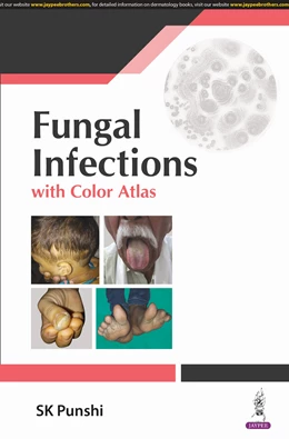 Abbildung von Punshi | Fungal Infections | 1. Auflage | 2024 | beck-shop.de