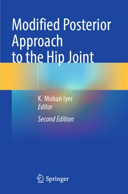 Abbildung von Iyer | Modified Posterior Approach to the Hip Joint | 2. Auflage | 2024 | beck-shop.de