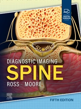 Abbildung von Ross / Moore | Diagnostic Imaging: Spine | 5. Auflage | 2025 | beck-shop.de
