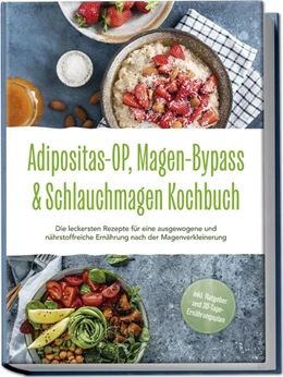 Abbildung von Hattermann | Adipositas-OP, Magen-Bypass & Schlauchmagen Kochbuch: Die leckersten Rezepte für eine ausgewogene und nährstoffreiche Ernährung nach der Magenverkleinerung - inkl. Ratgeber und 30-Tage-Ernährungsplan | 1. Auflage | 2024 | beck-shop.de