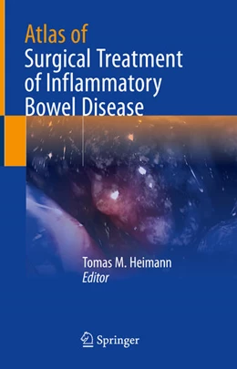 Abbildung von Heimann | Atlas of Surgical Treatment of Inflammatory Bowel Disease | 1. Auflage | 2024 | beck-shop.de