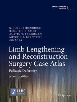 Abbildung von Rozbruch / Hamdy | Limb Lengthening and Reconstruction Surgery Case Atlas | 2. Auflage | 2025 | beck-shop.de