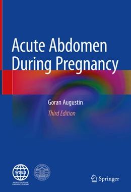 Abbildung von Augustin | Acute Abdomen During Pregnancy | 3. Auflage | 2024 | beck-shop.de