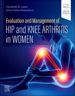 Abbildung von Lajam / Cohen-Rosenblum | Evaluation and Management of Hip and Knee Arthritis in Women | 1. Auflage | 2025 | beck-shop.de