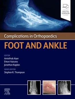 Abbildung von Aiyer / Vulcano | Complications in Orthopaedics: Foot and Ankle | 1. Auflage | 2026 | beck-shop.de