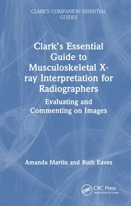 Abbildung von Martin | Clark's Essential Guide to Preliminary Clinical Evaluation of Musculoskeletal X-rays | 1. Auflage | 2025 | beck-shop.de