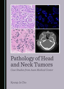 Abbildung von Cho | Pathology of Head and Neck Tumors | 1. Auflage | 2024 | beck-shop.de