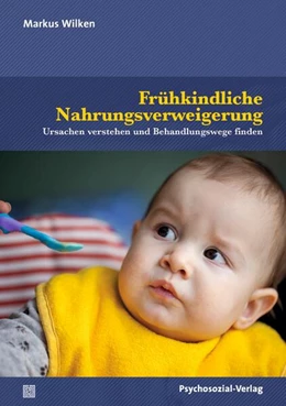 Abbildung von Wilken | Frühkindliche Nahrungsverweigerung | 1. Auflage | 2025 | beck-shop.de