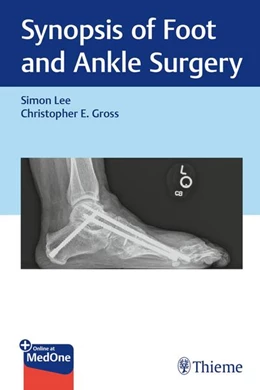 Abbildung von Lee / Gross | Synopsis of Foot and Ankle Surgery | 1. Auflage | 2025 | beck-shop.de